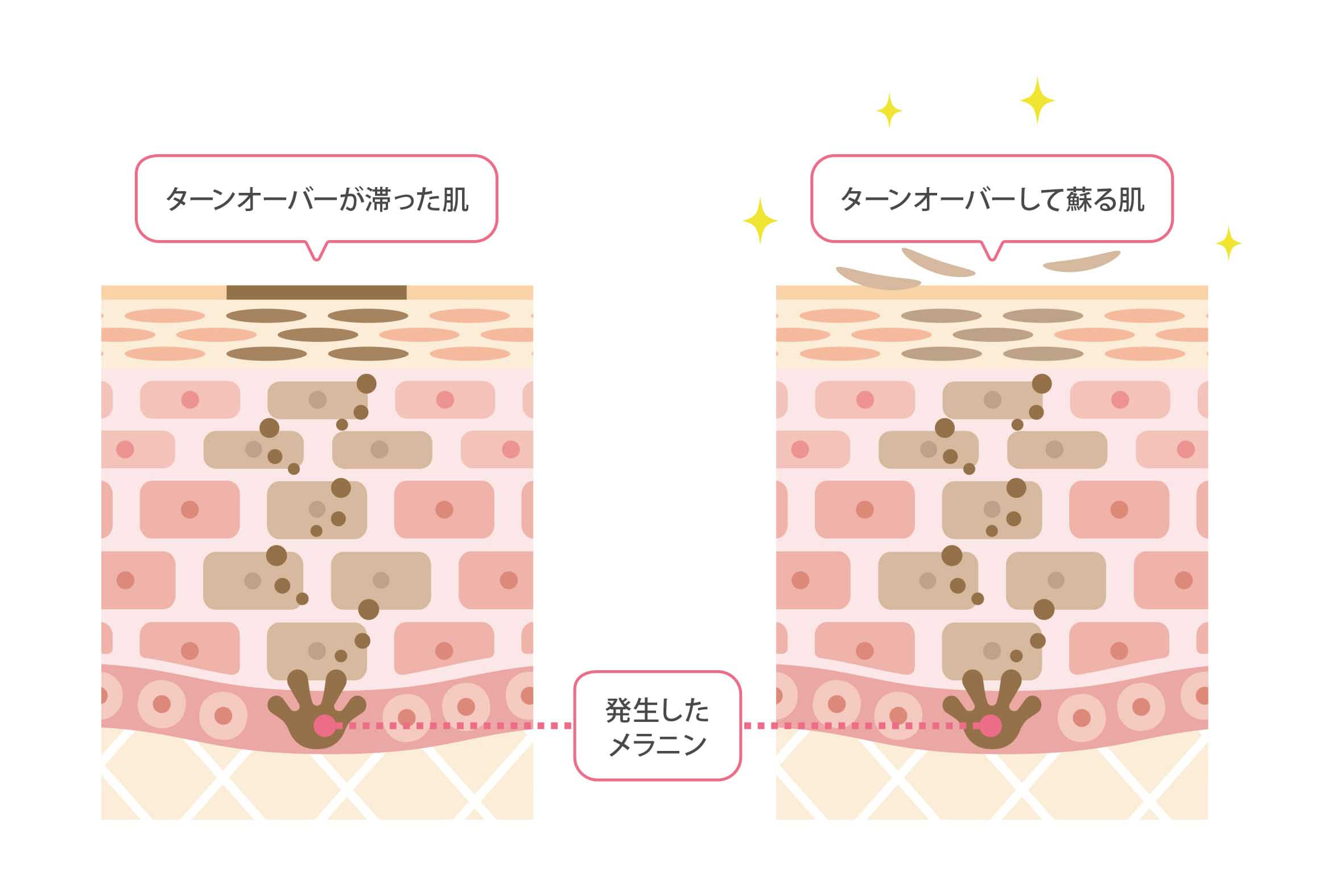 ターンオーバーの説明